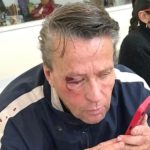 El actor Alfredo Adame fue brutalmente golpeado a finales del mes de septiembre al salir de su casa.