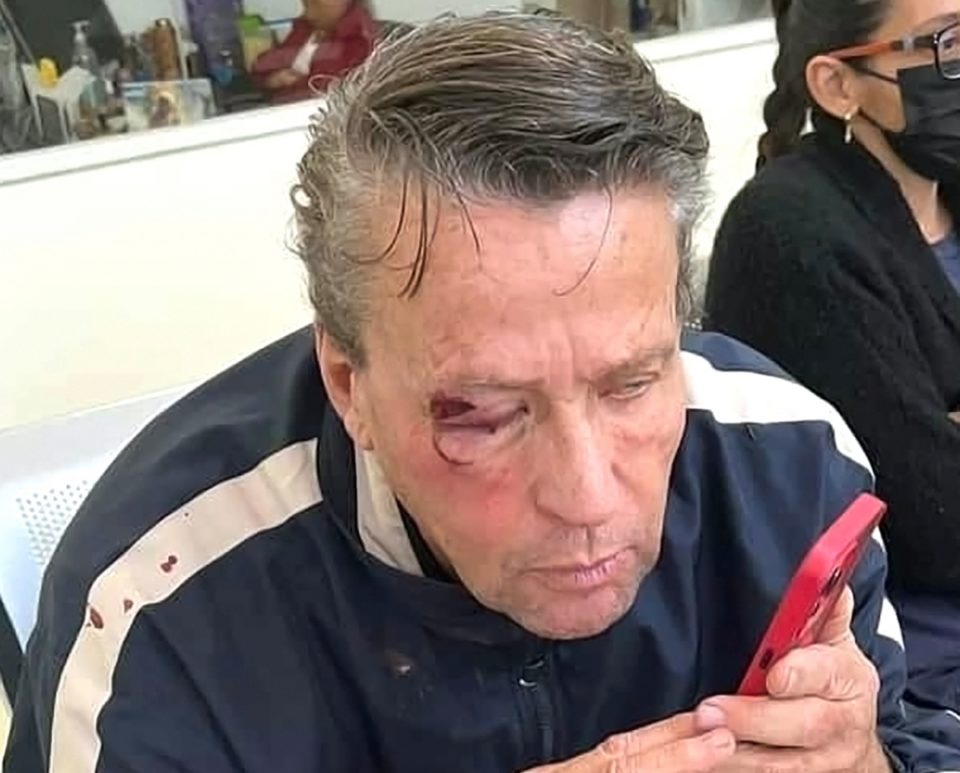 El actor Alfredo Adame fue brutalmente golpeado a finales del mes de septiembre al salir de su casa.