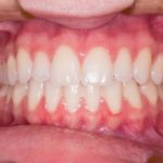 Tomar café o cuidar los dientes para que no se manchen: ¿una dicotomía real o falsa?