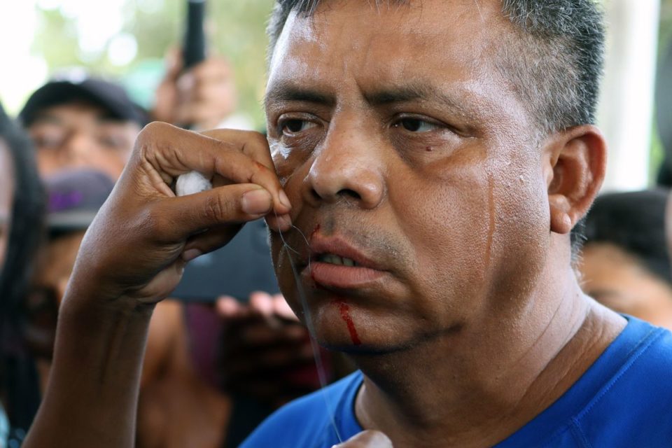 Un migrante se cose la boca durante una protesta en Chiapas.
